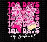 100 Days Of School PNG: Girls Coquette Bow